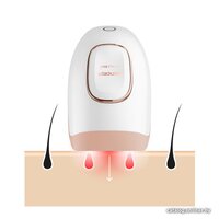 Concept IL3000 IPL Perfect Skin Image #2